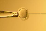 IN VITRO FERTILIZATION LABORATORY, IMAGE OBSERVED UNDER THE MICROSCOPE - INTRO CITOPLASMIC SPERM INJECTION [PST110004215]