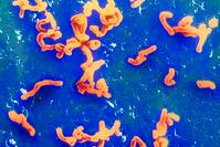 HELICOBACTER  PYLORI [PST110004366]