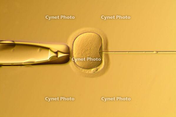 IN VITRO FERTILIZATION LABORATORY, IMAGE OBSERVED UNDER THE MICROSCOPE - INTRO CITOPLASMIC SPERM INJECTION [PST110004215]