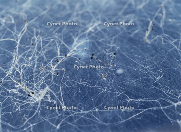 クモノスカビ [NNP110000007]