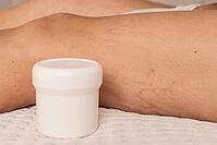 Close-up of a leg with visible varicose veins and capillaries. A white cream cream container is placed beside the leg on a textured surface [IBR125237491]
