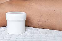 Close-up of a leg with visible varicose veins and capillaries. A white cream container is placed beside the leg on a textured surface [IBR125237496]