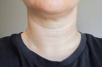A close-up view of womans neck . Lines on the neck. Wrinkles, age-related changes, rings of Venus, goosebumps and double chin. Skin care. [IBR125237504]