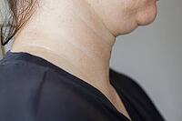 A close-up view of womans neck . Lines on the neck. Wrinkles, age-related changes, rings of Venus, goosebumps and double chin. Skin care. [IBR125237506]