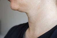 A close-up view of womans neck . Lines on the neck. Wrinkles, age-related changes, rings of Venus, goosebumps and double chin. Skin care. [IBR125237512]