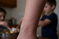 Human skin texture on adult forearm closeup, family cooking with children in kitchen, domestic caregiving, parental labor, dermatological health, selective focus on epidermic microstructures contrasts background activities of youngsters stirring ingredien [IBR125414206]