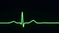 Abstract glowing green electrocardiogram waveform trace with a single sharp QRS spike, dark background, cardiac monitoring concept, clinical macro photography, AI generated [IBR125421227]