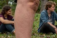 Detailed human leg skin texture with knee in focus during outdoor leisure in nature, blurred young friends sitting on grass in park conversing casually, dermatology and biological tactile sensation meet social youth connectivity, somatic awareness contras [IBR125446502]