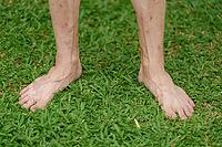 Close up of a person's bare feet standing on lush green grass, showcasing natural skin texture and grounding wellness concept [IBR125462046]