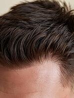 Close up of men's wig front hairline with thin skin base and short dark brown hair with gray strands, hair replacement system. AI generated [IBR125621309]