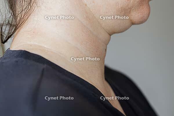 A close-up view of womans neck . Lines on the neck. Wrinkles, age-related changes, rings of Venus, goosebumps and double chin. Skin care. [IBR125237506]