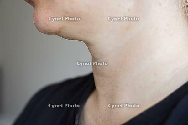 A close-up view of womans neck . Lines on the neck. Wrinkles, age-related changes, rings of Venus, goosebumps and double chin. Skin care. [IBR125237512]