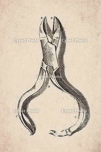 Dental Extraction Pliers and Forceps, Antique Dental Engraving, 1786, Digitally Remastered and Enhanced [IBR125411098]