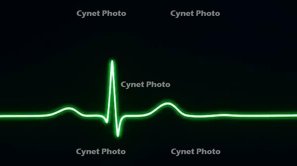 Abstract glowing green electrocardiogram waveform trace with a single sharp QRS spike, dark background, cardiac monitoring concept, clinical macro photography, AI generated [IBR125421227]