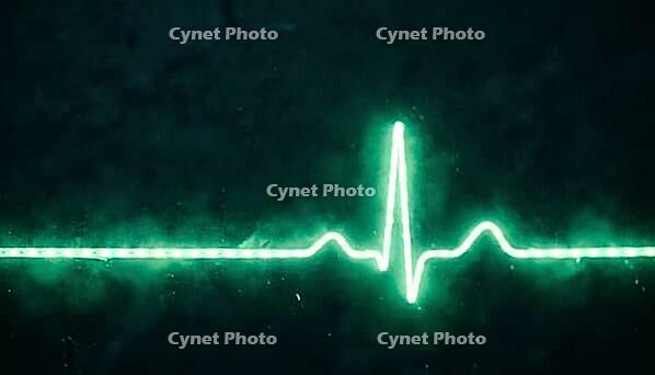 Abstract glowing green electrocardiogram waveform trace with a single sharp QRS spike, dark background, cardiac monitoring concept, clinical macro photography, AI generated [IBR125421278]