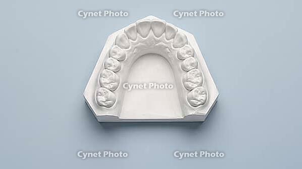 Close-up of a white gypsum plaster cast showing a lower dental arch bite mark impression, pale blue grey background, forensic odontology macro photography, AI generated [IBR125446465]