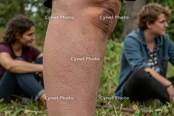 Detailed human leg skin texture with knee in focus during outdoor leisure in nature, blurred young friends sitting on grass in park conversing casually, dermatology and biological tactile sensation meet social youth connectivity, somatic awareness contras [IBR125446502]
