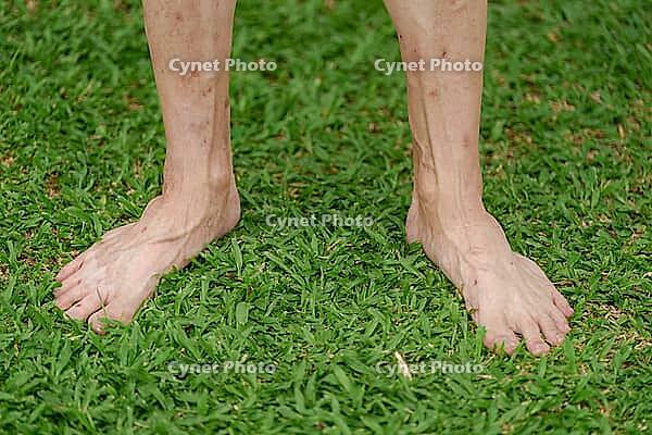 Close up of a person's bare feet standing on lush green grass, showcasing natural skin texture and grounding wellness concept [IBR125462046]