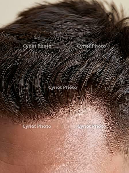 Close up of men's wig front hairline with thin skin base and short dark brown hair with gray strands, hair replacement system. AI generated [IBR125621309]