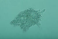 倍率による見え方の変化　アメーバ　B3 [XCE110002251]