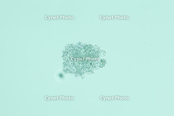 倍率による見え方の変化　アメーバ　A2 [XCE110002247]