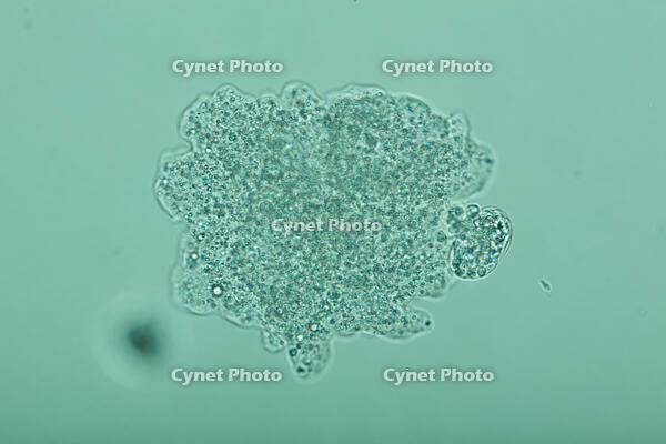 倍率による見え方の変化　アメーバ　A3 [XCE110002248]
