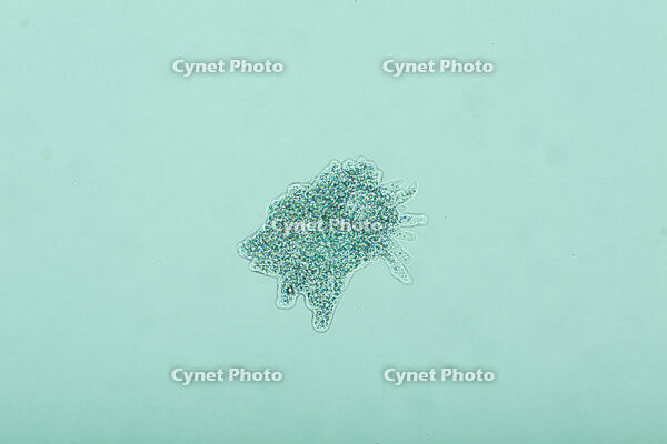 倍率による見え方の変化　アメーバ　B2 [XCE110002250]