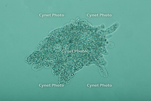 倍率による見え方の変化　アメーバ　B3 [XCE110002251]